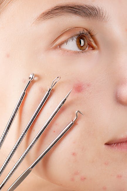 Close-up image of a young person's face, focusing on the right side, showing clear skin with some acne and redness. Several stainless steel acne extraction tools with various shaped tips are held near the cheek, positioned vertically and angled towards the skin, indicating a skin care or acne treatment procedure. The background is blurred, emphasizing the face and tools, with natural lighting highlighting facial features and tool reflections. The scene appears to depict a skinnovation or facial treatment setting, relevant to skincare and personal care services.